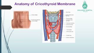 Cricothyroidotomy [upl. by Elimaj]