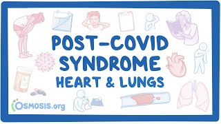 PostCOVID syndrome Heart and lungs [upl. by Melli626]