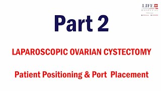 Laparoscopic Ovarian Cystectomy I Patient Positioning amp Port Placement Part 2 [upl. by Menon831]