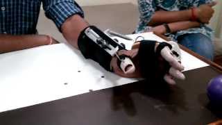 DHS Dynamic Hand Splint spastic hand splint [upl. by Canice]