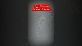 Egg of Human Parasite Pinworm Enterobius vermicularis [upl. by Files]