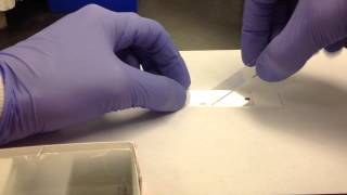 Hematology Making a Peripheral Blood Smear [upl. by Ebag]