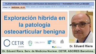 667 Exploración híbrida en la patología osteoarticular benigna [upl. by Yelir]