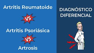 Artritis Reumatoide vs Artritis Psoriásica vs Artrosis Diagnóstico diferencial [upl. by Zulch]