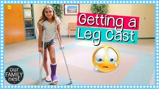 GETTING A LEG CAST FOR BROKEN FOOT  DANCE INJURY [upl. by Eedolem]