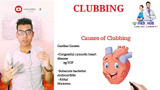 Clubbing Causes  definition waterglass nail carcinoma mbbs clinical medicine  Md Ayub [upl. by Ennovyhc]