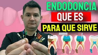 Que es la Endodoncia [upl. by Ettenad]