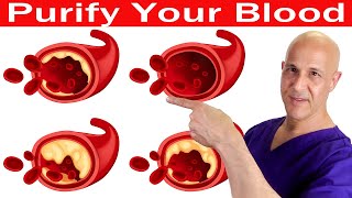 How to Naturally Cleanse Your Blood  Dr Mandell [upl. by Mairym468]