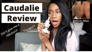 Caudalie Vinoperfect Radiance Dark Spot Serum and Moisturizer with Niacinamide Review  Regina Ramos [upl. by Aikenahs]