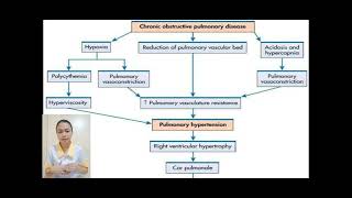 Cor pulmonale Tan BSN3D [upl. by Aroc]