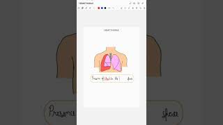 HEMOTHORAX [upl. by Pain]