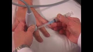 How To UltrasoundGuided Hand Injection Scanning Technique Video [upl. by Amity]