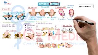 Ficha resumen Obstetricia Distocias fetales ENAMENARMSERUMS [upl. by Sherwynd639]