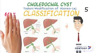 Choledochal Cyst in 1 minute [upl. by Eissirhc]