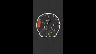 Brain Herniation Syndromes [upl. by Sacken]