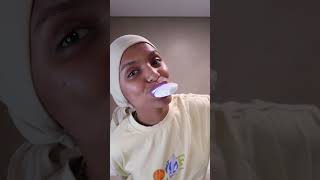 15 mins every day can whiten teeth up to 10shades mustwatch [upl. by Fried973]