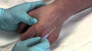 Intravenous Catheter Placement [upl. by Campy473]