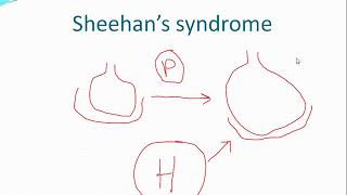 Diseases Of Pituitary Gland [upl. by Omoj]