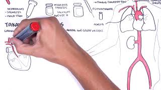 Giant cell Arteritis and Takayasu arteritis Large Vessel Vasculitis  signs pathophysiology [upl. by Ahsied]