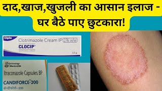 दादखाज खुजली का Powerful Treatment quotseborrheic dermatitisquot [upl. by Best166]