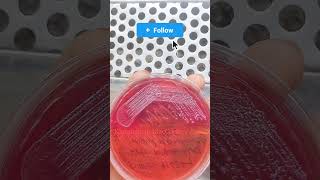 klebsiella in MacConkey Agar। microscope microbiology bacteria youbtube science [upl. by Blondy853]