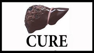 Part 1 of 5 LIVER CIRRHOSIS CURES  Natural Cure Treatment Remedy Liver Flush Protocol [upl. by Ahtnamys765]