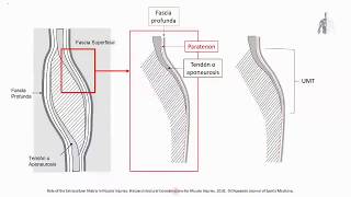 Manejo de las lesiones musculares del deportista anatomía de las lesiones musculares [upl. by Dalton76]