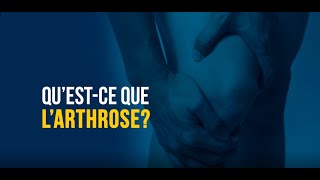 Questce que larthrose Une solution de traitement potentielle  SYNVISC®SynviscOne® [upl. by Aikemot602]