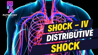 Understanding Distributive Shock  By Dr Aditi Kumar [upl. by Sylram]