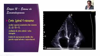 EPISÓDIO 11  20  Os 50 passos para a realização de um ecocardiograma de excelência [upl. by Freudberg291]