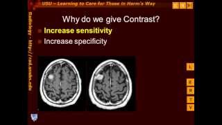 Introduction to Contrast Enhancement [upl. by Darooge677]