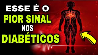 7 SINAIS de GRAVIDADE no DIABETES [upl. by Eeslek]