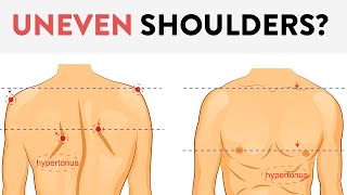 UNEVEN Shoulders Is one shoulder higher than the other Heres how to fix it [upl. by Aronel]