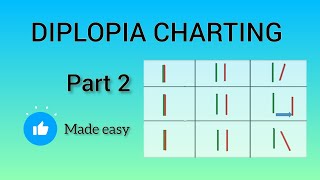 DIPLOPIA CHARTING PART 2 IN TAMIL [upl. by Enad768]