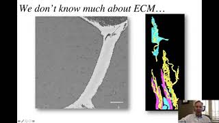 Intraoperative and Laboratory Studies of Human Muscle Contractures by Dr Rich Lieber NW University [upl. by Lang]