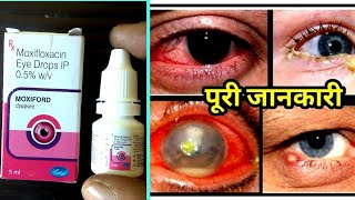 Moxifloxacin Eye Drops Uses in Hindi  Moxiford eye drop uses in hindi [upl. by Brecher]