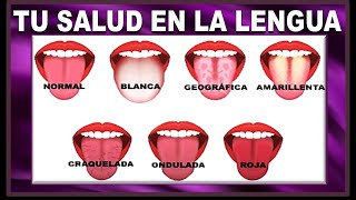 CUÁLES SON LOS TIPOS DE ENFERMEDADES EN LA LENGUA DIAGNÓSTICO Y TRATAMIENTOS [upl. by Meijer]