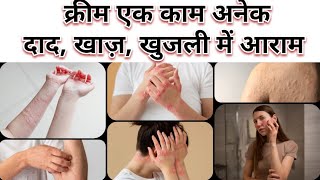 दाद खाज और खुजली में आराम सिर्फ 2 दिनों में। eczema psoriasis and dermatitis treatment [upl. by Acinorrev]