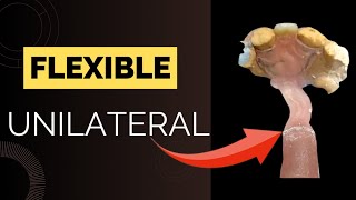 prótesis flexible unilateral Enmuflado [upl. by Loughlin]