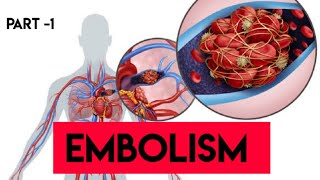 Embolism  Part 1 Pathology  Decompression Sickness  Amniotic Fluid Embolism  Harsh Mohan [upl. by Yromem]