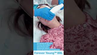 Forever Young BBL Ultimate Solution for Sun Damage Wrinkles and More [upl. by Forward]