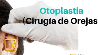 Cirugía de orejas otoplastia [upl. by Euqinamod96]