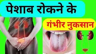 मल मूत्र वेग को रोकने के गम्भीर नुकसान  Risk of Holding Urine  Detox Your Body [upl. by Gefell898]