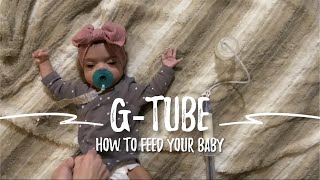 How to feed your baby with a GTube feeding tube [upl. by Rimidalg]