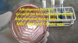 Alkaligenes faecalis Colony Morphology on Macconkey agar and Biochemical Reactions Demonstration [upl. by Sesilu703]