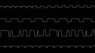 4mat  Empty AntiAuto no Beeper [upl. by Claudell968]