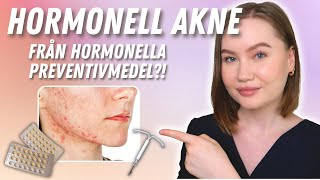 Varför du har Hormonell Akne  Har hormonella preventivmedel någon inverkan [upl. by Bara248]