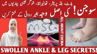 Foot And Ankle Swelling What Causes It  Edema Causes amp Treatment Listen Your Body [upl. by Kazimir]