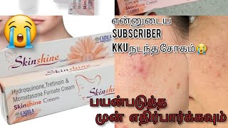 SkinShine cream tamil review 😭என்னுடைய சப்ஸ்க்ரைபருக்கு நடந்த சோகம்😭 [upl. by Monte]