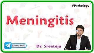 4 Meningitis  USMLE Step 1 Pathology [upl. by Frederico]